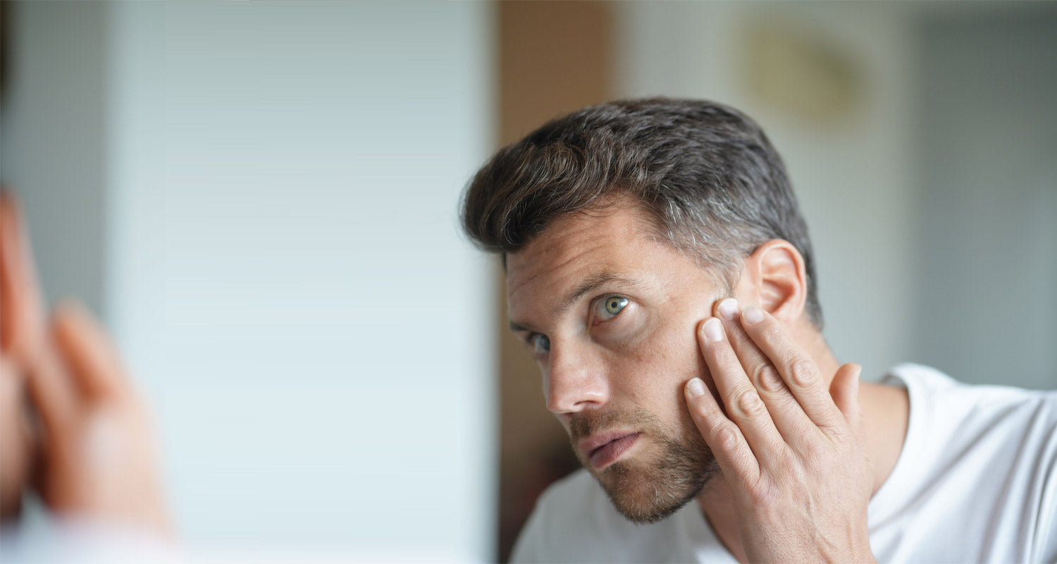 Männerproblem ölige Haut – So pflegst Du Gesicht und Körper richtig